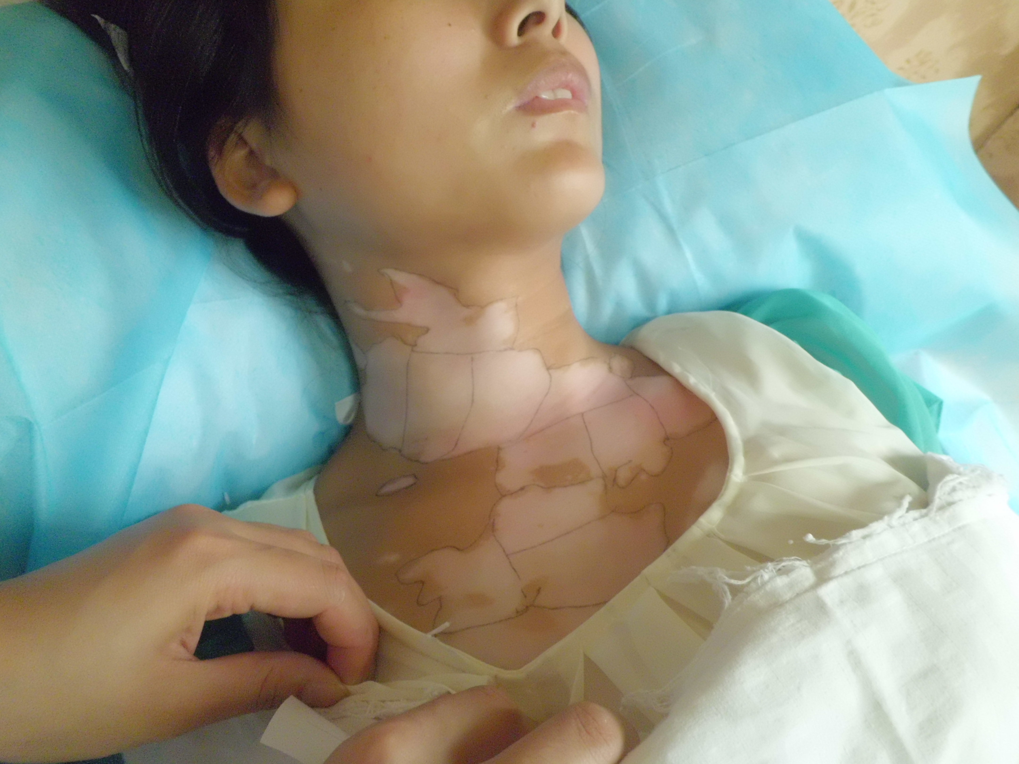患者症状